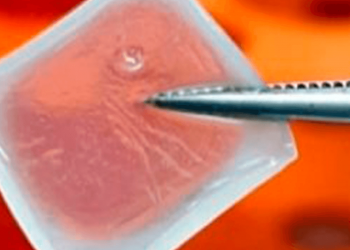 Biocurativo de células-tronco permite o tratamento inteligente de feridas e queimaduras
