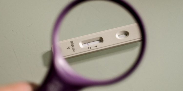 Boa Notícia: Anvisa aprova o autoteste de covid-19