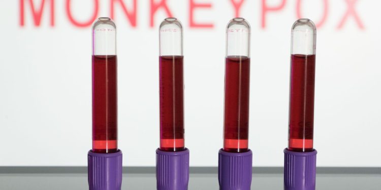 Alerta Vermelho: Varíola dos macacos: Brasil tem 978 casos da doença