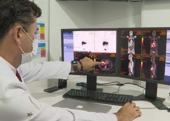 Próstata com tumor tem novo tratamento com radioterapia reduzida