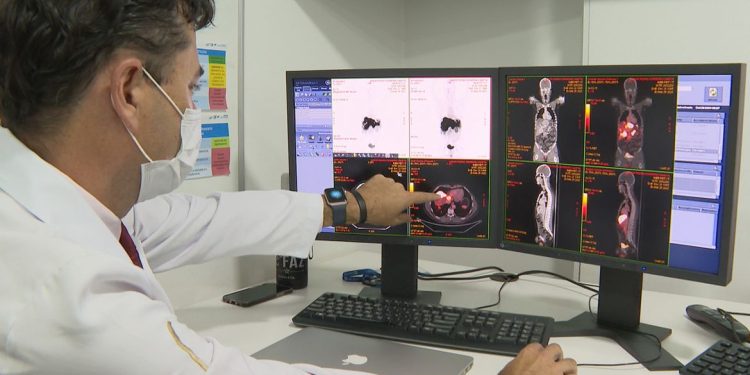Próstata com tumor tem novo tratamento com radioterapia reduzida