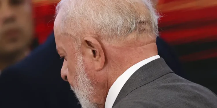 Lula fará novo procedimento médico nesta quinta