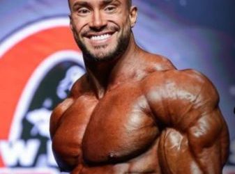 Fisiculturista brasileiro tem HEMORRAGIA após cirurgia estética antes de competição!