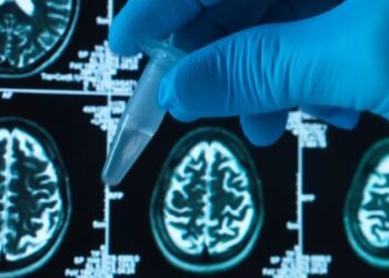 REVOLUÇÃO ANTI-ALZHEIMER! Donanemabe: novo medicamento age na CAUSA da doença e retarda o declínio cognitivo!