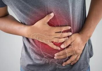 SAÚDE DIGESTIVA: Síndrome do Intestino Irritável afeta rotina e exige atenção aos sinais de alerta