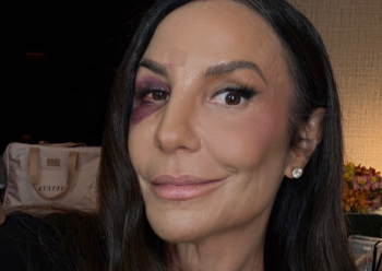 IVETE SANGALO ROMPE O SILÊNCIO: Cantora afasta rumores de agressão e detalha cirurgia após queda por desmaio