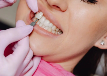 SORRISO RECONSTRUÍDO: SUS passa a oferecer implantes e próteses gratuitos para mulheres vítimas de violência