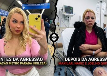 COVARDIA NOS TRILHOS: AGRESSOR QUEBRA MAXILAR DE JOVEM NO METRÔ.